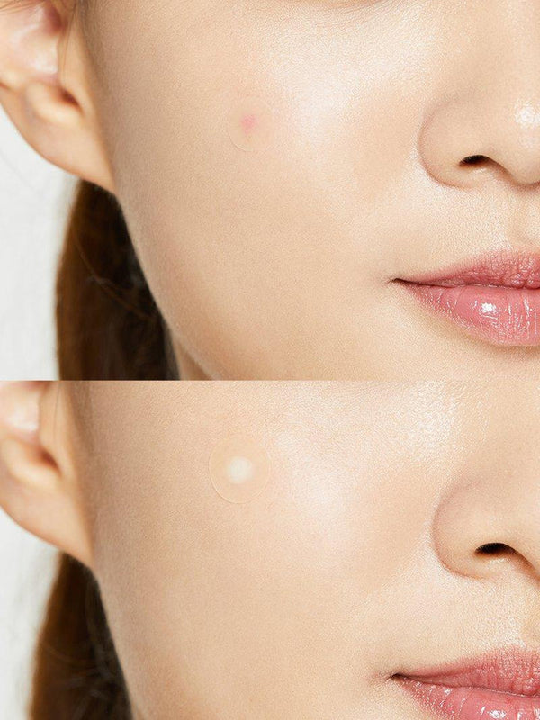 [COSRX] Acne Pimple Master Patch 24ea 5
